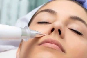 Best Actinic Keratoses Removal 3 Actinic keratoses Newmarket solutions - book in today!